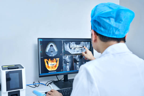 Best Dentist for Tooth Abscess  in Clear Lake, WA